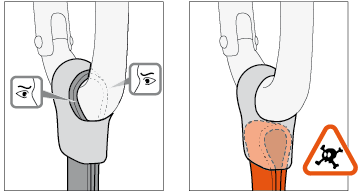 Precauciones de instalaciÃ³n de un STRING