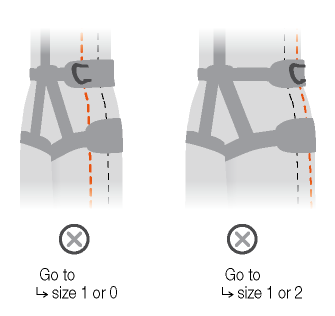 Mauvaises positions des points latéraux