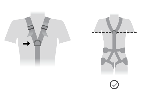 The sternal attachment point should be placed at chest level.