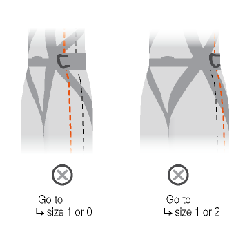 - Poorly positioned side points