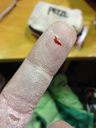 Lena Herrmann Fingerpflege Cut Klettern