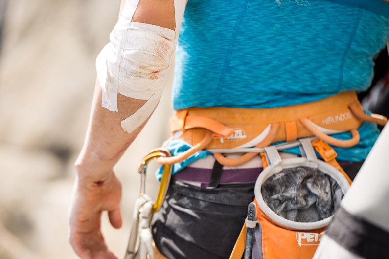 Emily Harrington's elbow, battered from the "Monster Offwidth" on Golden Gate. Photo: Jon Glassberg